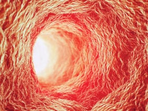 New Catheter Lets Doctors See Inside Arteries