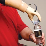 When Will Mind-Controlled Prosthetics Reach Consumers?