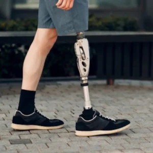 Does Osseointegration Improve Amputees' Balance?